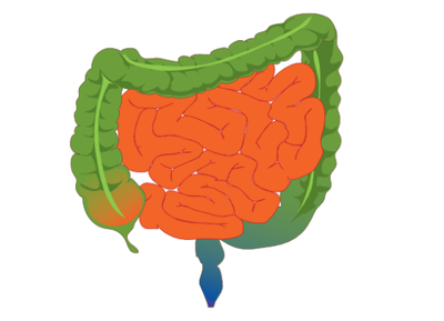 Why Your Leaky Gut Will Kill You And What To Do About It