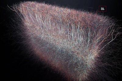 Scientists Have Discovered a Multidimensional Universe Inside the Brain