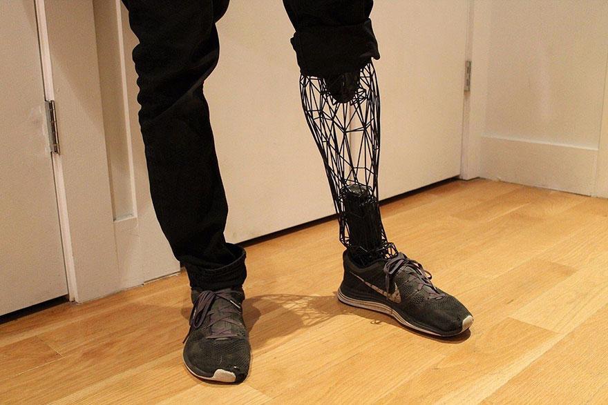 Technology Revolution | 3D Printed Titanium Prosthetics